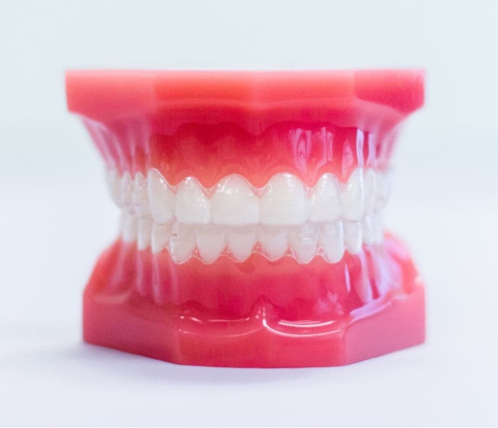 invisalign aligners on plastic model