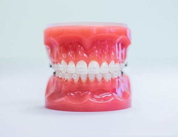 orthodontic treatments