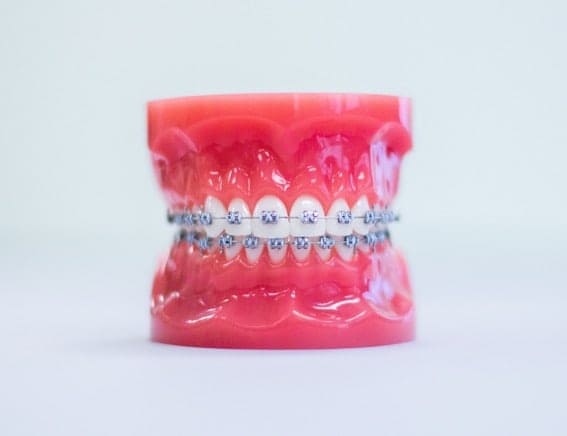 orthodontic treatments