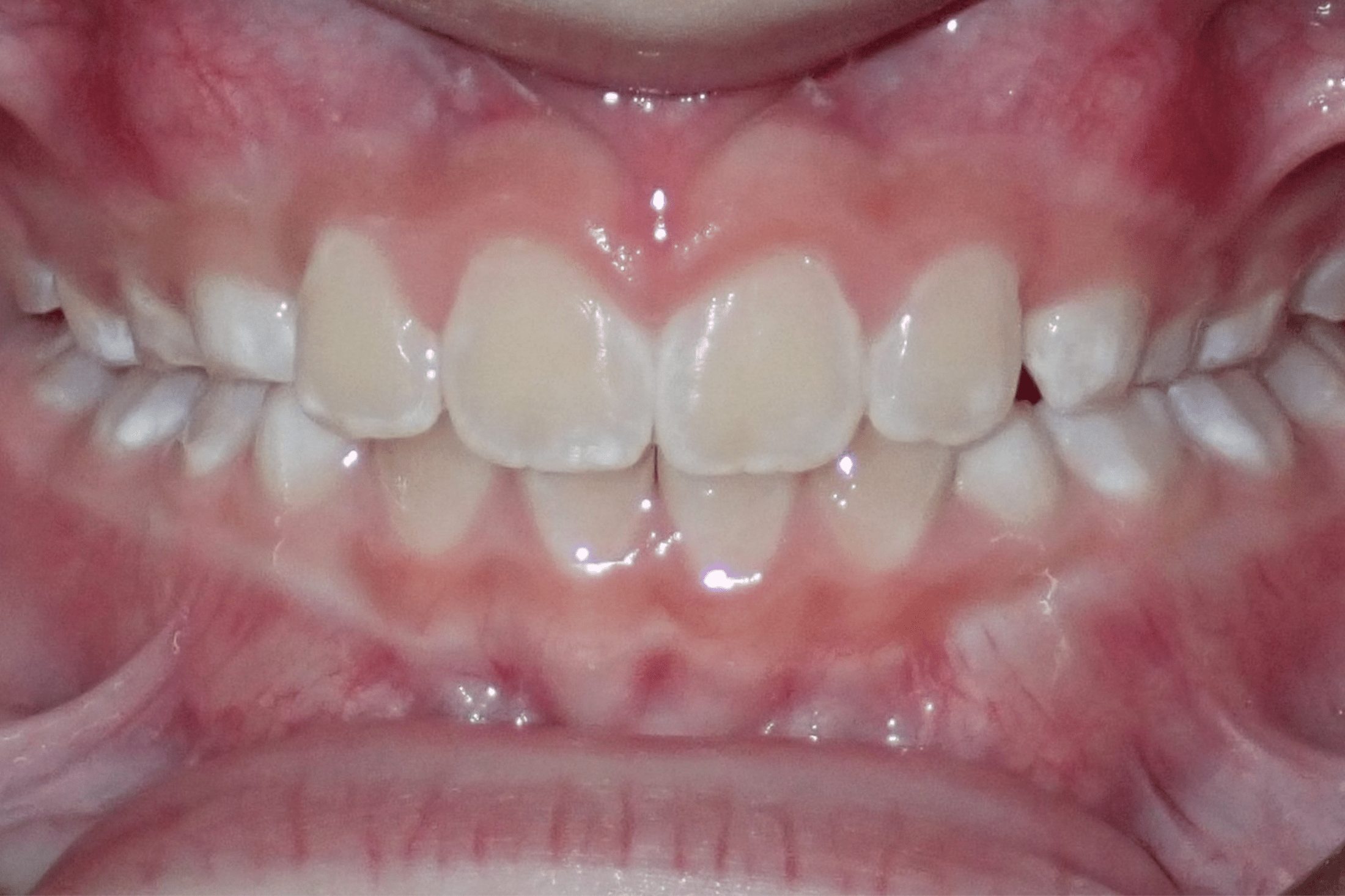 Patient-2-After-2