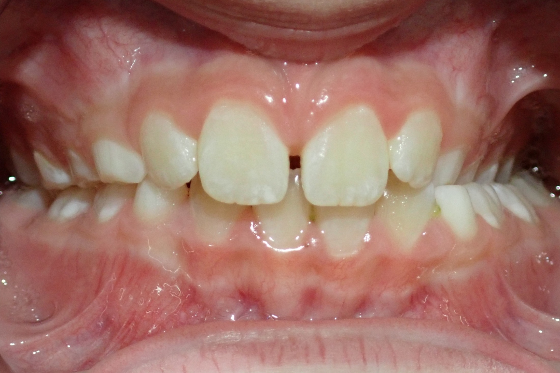 Patient 2 - Before