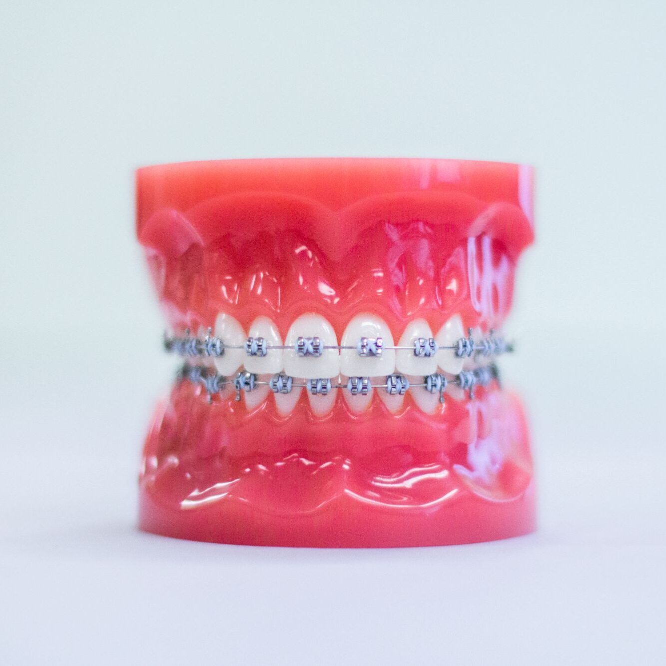 orthodontic treatments