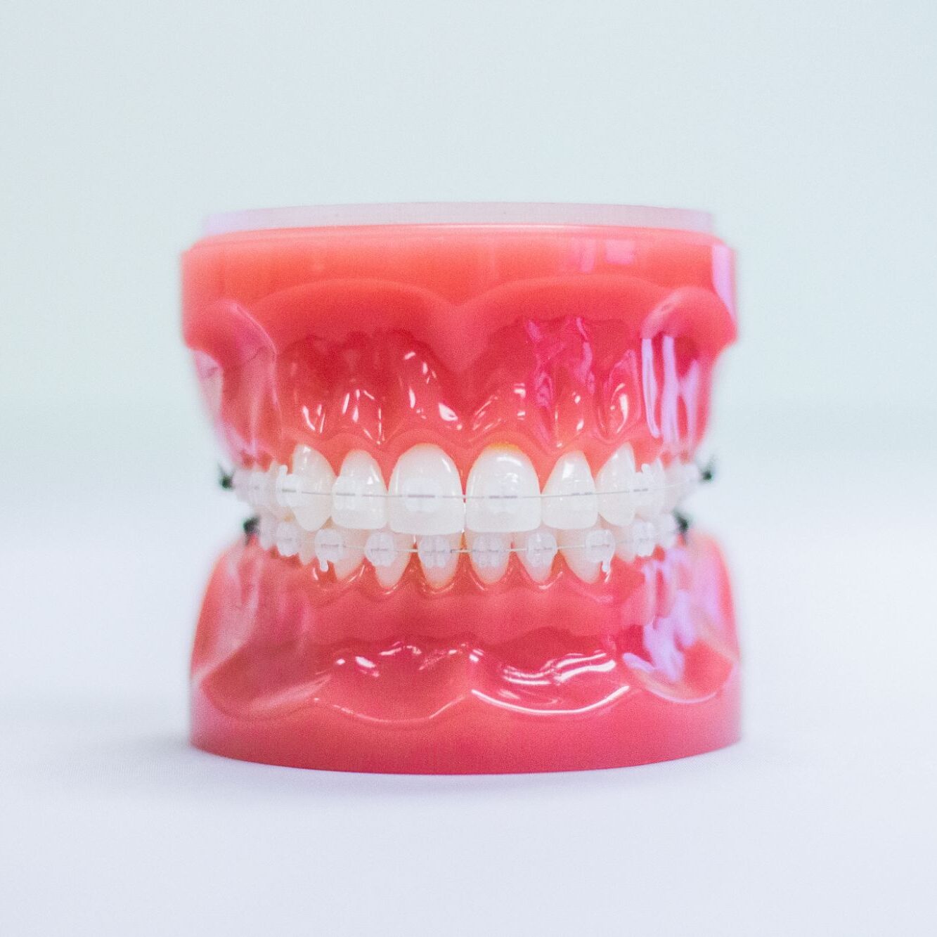 orthodontic treatments